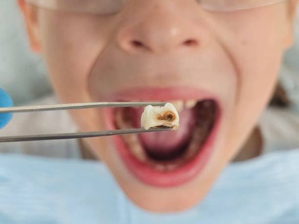 Best Mobile Emergency Dentist in Hillsboro, KS